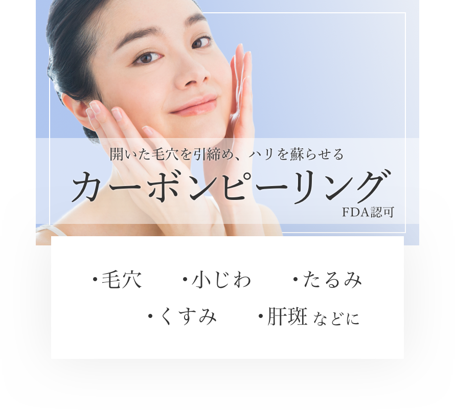 カーボンピーリング レーザー治療 恵比寿院 東京都渋谷区 美容皮膚科シロノクリニック