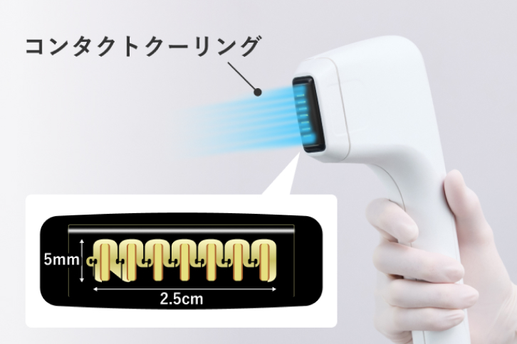 エネルギー堆積のモニタリング