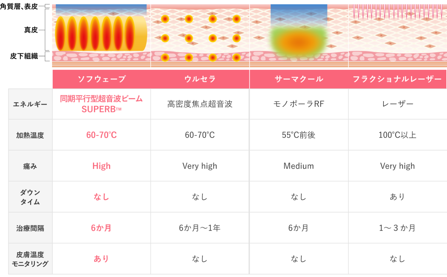 ソフウェーブとは