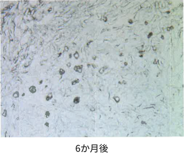 分解されていく様子6か月後