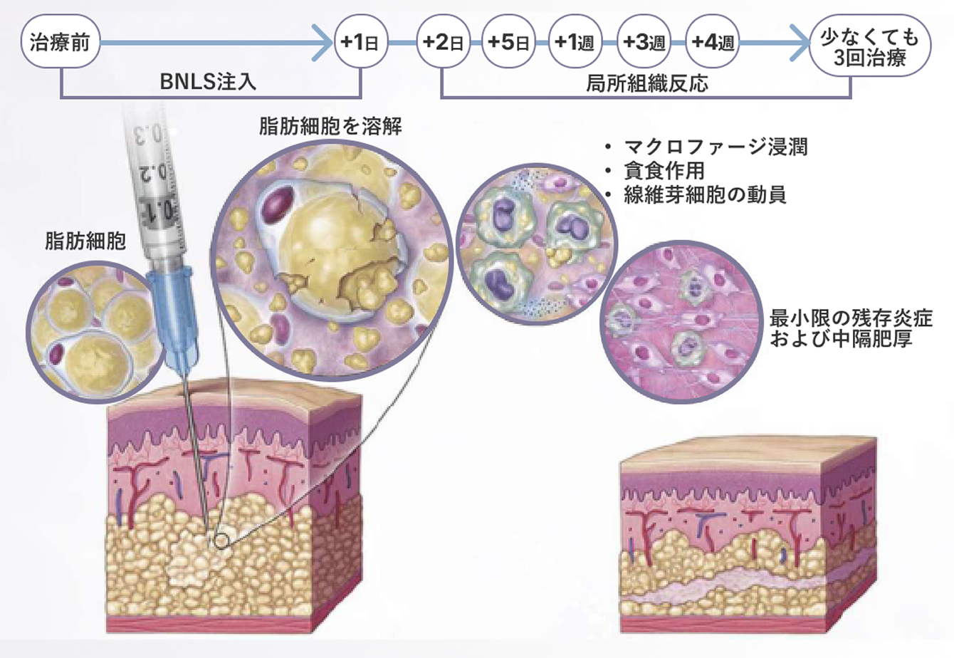 bnlsのメカニズムの図