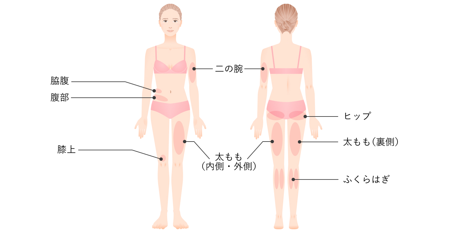 適応部位のイラスト