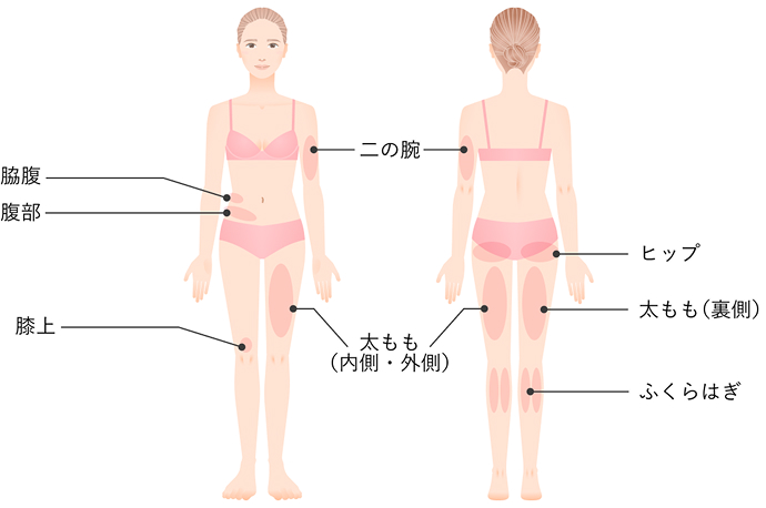 適応部位のイラスト