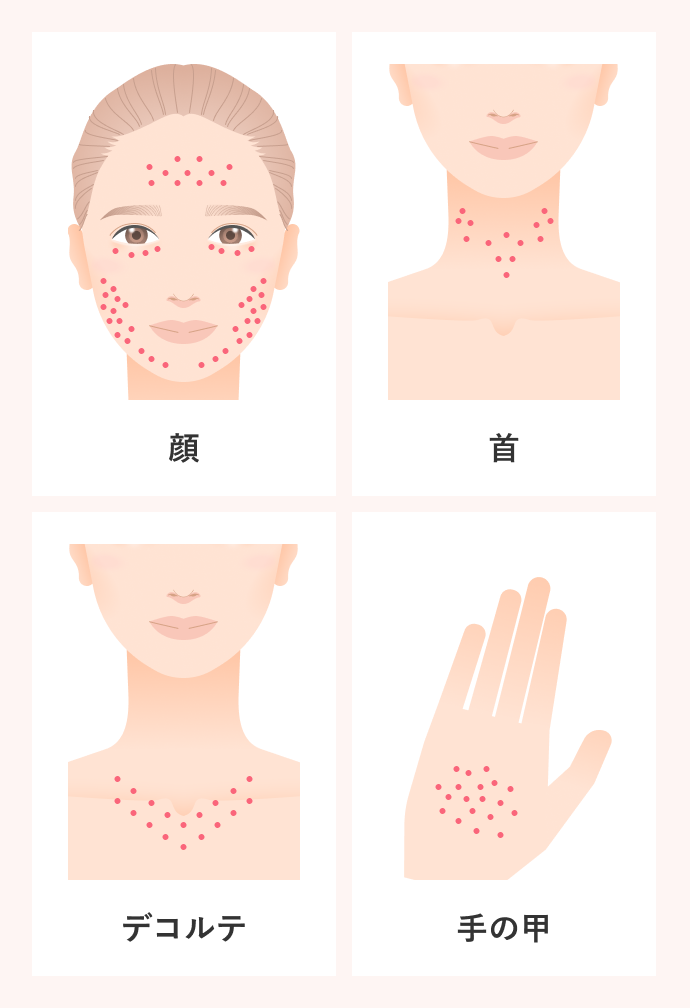 顔・首・デコルテ・手の甲