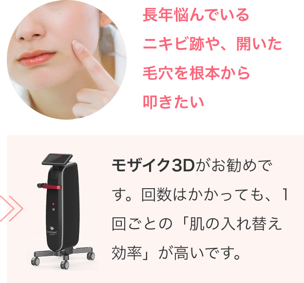 モザイク3Dのまとめ