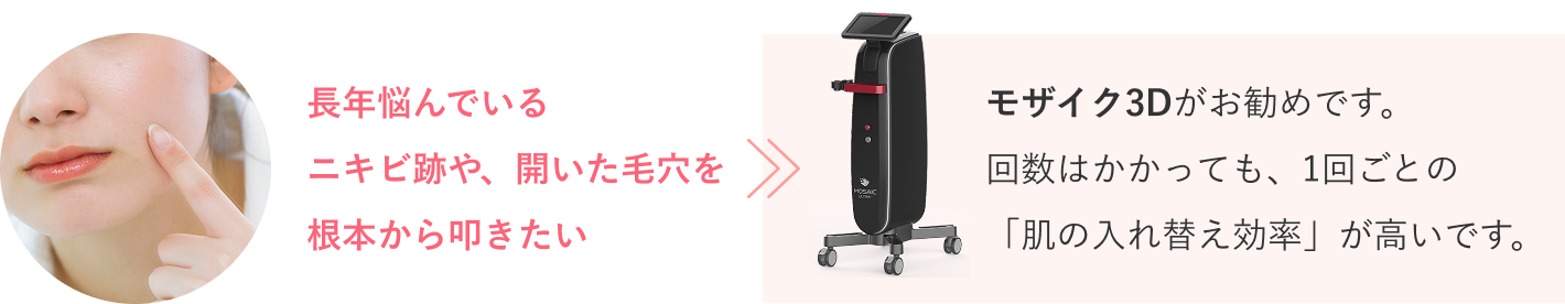 モザイク3Dのまとめ