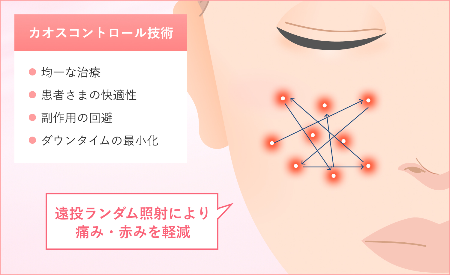 モザイク3Dカオスコントロール技術