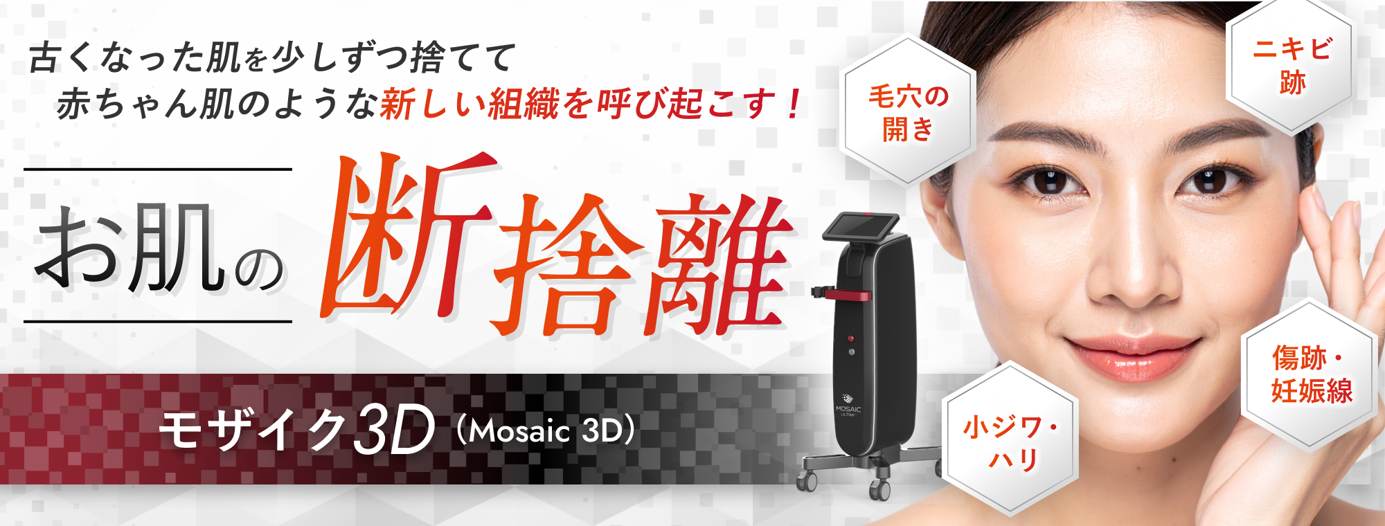 フラクショナルレーザー（モザイク3D）